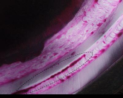  Индикация трещины по границе сварного шва люк-лаза изотермического хранилища жидкого аммиака, обнаруженная капиллярным контролем 